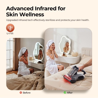 JIGOO J300 Pro Intelligenter Doppelbecher-Matratzenstaubsauger EU